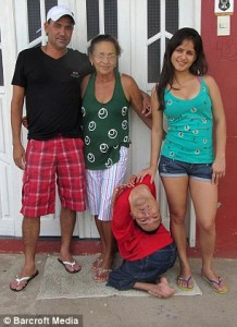 Abnornal baby