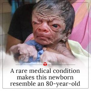 old-baby