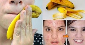 banana-peels