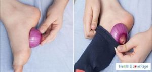 Onion in stockings