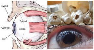 eye-garlic